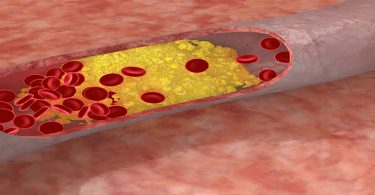 Cholesterol 101 – Understanding Basics