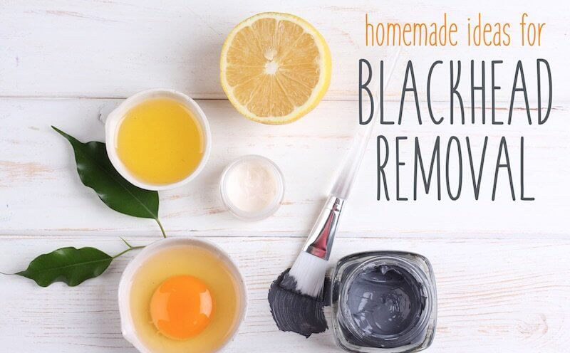 Natural Ways to Get Rid of Blackheads